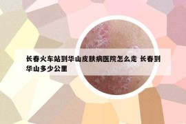 長(zhǎng)春火車站到華山皮膚病醫(yī)院怎么走 長(zhǎng)春到華山多少公里