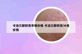 卡泊三醇軟膏市場(chǎng)價(jià)格 卡泊三醇軟膏30克價(jià)錢(qián)
