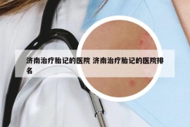 濟(jì)南治療胎記的醫(yī)院 濟(jì)南治療胎記的醫(yī)院排名