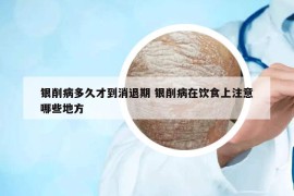 銀削病多久才到消退期 銀削病在飲食上注意哪些地方