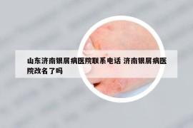 山東濟(jì)南銀屑病醫(yī)院聯(lián)系電話 濟(jì)南銀屑病醫(yī)院改名了嗎