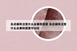 白點(diǎn)癲風(fēng)注意什么水果和蔬菜 白點(diǎn)癲風(fēng)注意什么水果和蔬菜可以吃