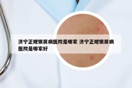 濟(jì)寧正規(guī)銀屑病醫(yī)院是哪家 濟(jì)寧正規(guī)銀屑病醫(yī)院是哪家好