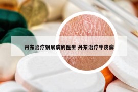 丹東治療銀屑病的醫(yī)生 丹東治療牛皮癬