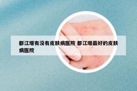 都江堰有沒有皮膚病醫(yī)院 都江堰最好的皮膚病醫(yī)院