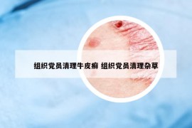 組織黨員清理牛皮癬 組織黨員清理雜草