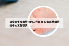 公安局牛皮癬管控的工作職責(zé) 公安局基礎(chǔ)管控中心工作職責(zé)