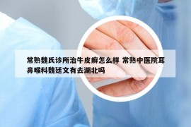 常熟魏氏診所治牛皮癬怎么樣 常熟中醫(yī)院耳鼻喉科魏廷文有去湖北嗎