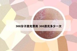 308分子激光費用 308激光多少一次