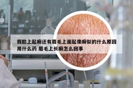 我臉上起癬還有眉毛上面起像癬似的什么原因用什么藥 眉毛上長癬怎么回事
