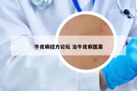 牛皮癬經(jīng)方論壇 治牛皮癬醫(yī)案