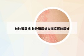 長沙銀屑病 長沙銀屑病去哪家醫(yī)院最好