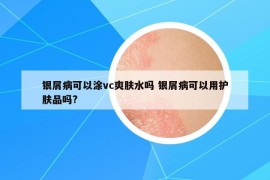 銀屑病可以涂vc爽膚水嗎 銀屑病可以用護(hù)膚品嗎?