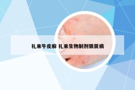 禮來牛皮癬 禮來生物制劑銀屑病