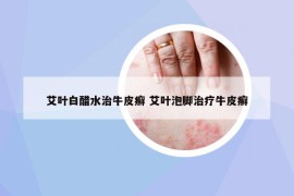 艾葉白醋水治牛皮癬 艾葉泡腳治療牛皮癬