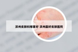 濱州皮膚科哪里好 濱州最好皮膚醫(yī)院