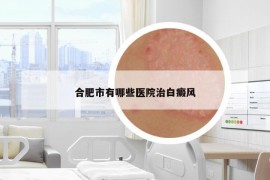 合肥市有哪些醫(yī)院治白癜風