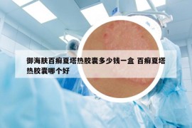 御海膚百癬夏塔熱膠囊多少錢一盒 百癬夏塔熱膠囊哪個(gè)好