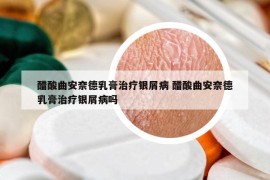 醋酸曲安奈德乳膏治療銀屑病 醋酸曲安奈德乳膏治療銀屑病嗎