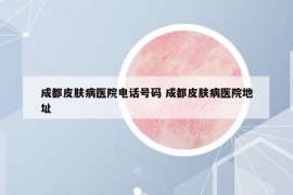 成都皮膚病醫(yī)院電話號碼 成都皮膚病醫(yī)院地址