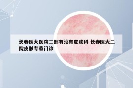 長(zhǎng)春醫(yī)大醫(yī)院二部有沒有皮膚科 長(zhǎng)春醫(yī)大二院皮膚專家門診