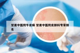 甘肅中醫(yī)院牛皮癬 甘肅中醫(yī)院皮膚科專家排名