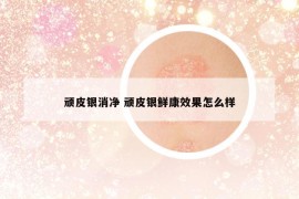 頑皮銀消凈 頑皮銀鮮康效果怎么樣
