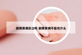 副銀屑病忌口嗎 副銀屑病不能吃什么