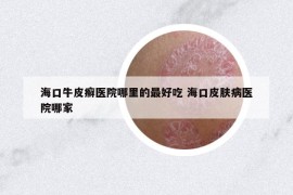 ?？谂Ｆぐ_醫(yī)院哪里的最好吃 ?？谄つw病醫(yī)院哪家