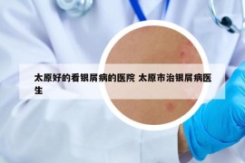 太原好的看銀屑病的醫(yī)院 太原市治銀屑病醫(yī)生