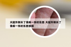 大腿外側(cè)長(zhǎng)了像癬一樣的東西 大腿外側(cè)長(zhǎng)了像癬一樣的東西很癢