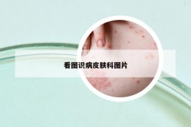 看圖識病皮膚科圖片