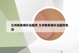 蘭州銀屑病診治醫(yī)院 蘭州銀屑病診治醫(yī)院電話