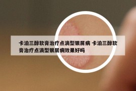 卡泊三醇軟膏治療點(diǎn)滴型銀屑病 卡泊三醇軟膏治療點(diǎn)滴型銀屑病效果好嗎