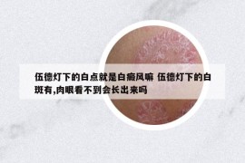 伍德燈下的白點就是白癜風嘛 伍德燈下的白斑有,肉眼看不到會長出來嗎