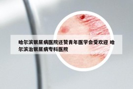 哈爾濱銀屑病醫(yī)院還贊青年醫(yī)學(xué)會受歡迎 哈爾濱治銀屑病?？漆t(yī)院