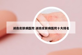 湖南皮膚病醫(yī)院 湖南皮膚病醫(yī)院十大排名