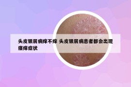 頭皮銀屑病癢不癢 頭皮銀屑病患者都會出現(xiàn)瘙癢癥狀