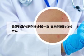 最好的生物制劑多少錢一支 生物制劑的價(jià)格貴嗎