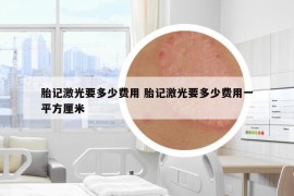 胎記激光要多少費(fèi)用 胎記激光要多少費(fèi)用一平方厘米