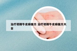 治療初期牛皮癬偏方 治療初期牛皮癬偏方大全
