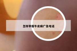 怎樣舉報(bào)牛皮癬廣告電話