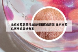北京空軍總醫(yī)院皮膚科銀屑病套裝 北京空軍總醫(yī)院銀屑病專家