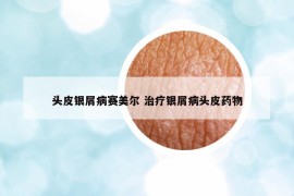 頭皮銀屑病賽美爾 治療銀屑病頭皮藥物