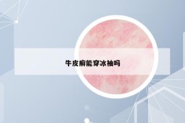 牛皮癬能穿冰袖嗎