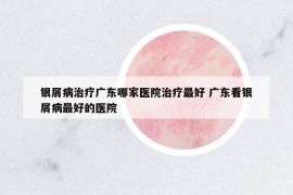 銀屑病治療廣東哪家醫(yī)院治療最好 廣東看銀屑病最好的醫(yī)院