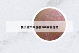關(guān)于城市牛皮癬100字的作文