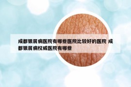 成都銀屑病醫(yī)院有哪些醫(yī)院比較好的醫(yī)院 成都銀屑病權(quán)威醫(yī)院有哪些