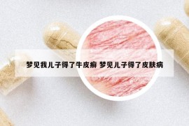 夢(mèng)見(jiàn)我兒子得了牛皮癬 夢(mèng)見(jiàn)兒子得了皮膚病