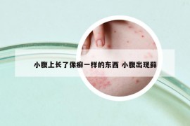 小腹上長了像癬一樣的東西 小腹出現(xiàn)蘚